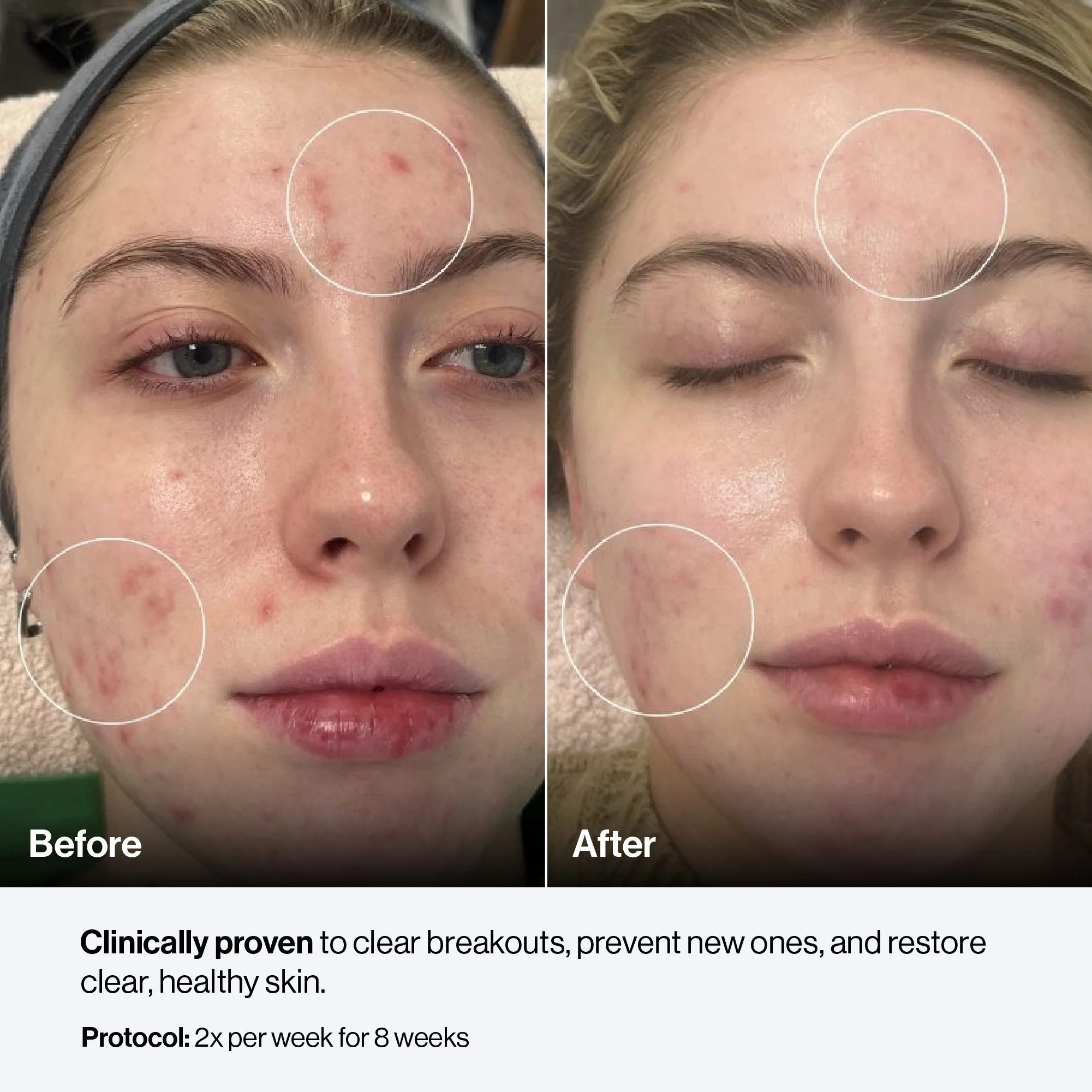 Celluma PRO - Image 11