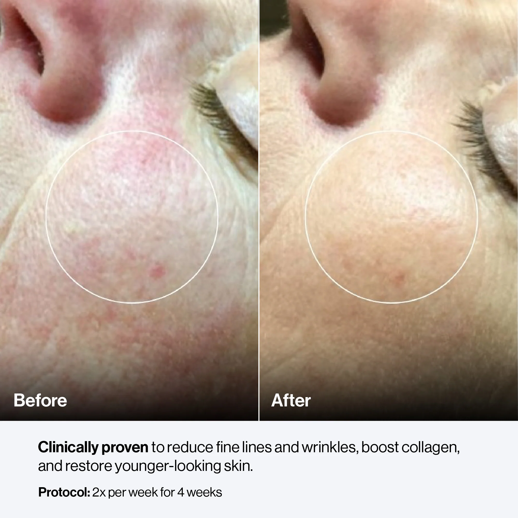 Celluma CONTOUR PLUS - Image 21