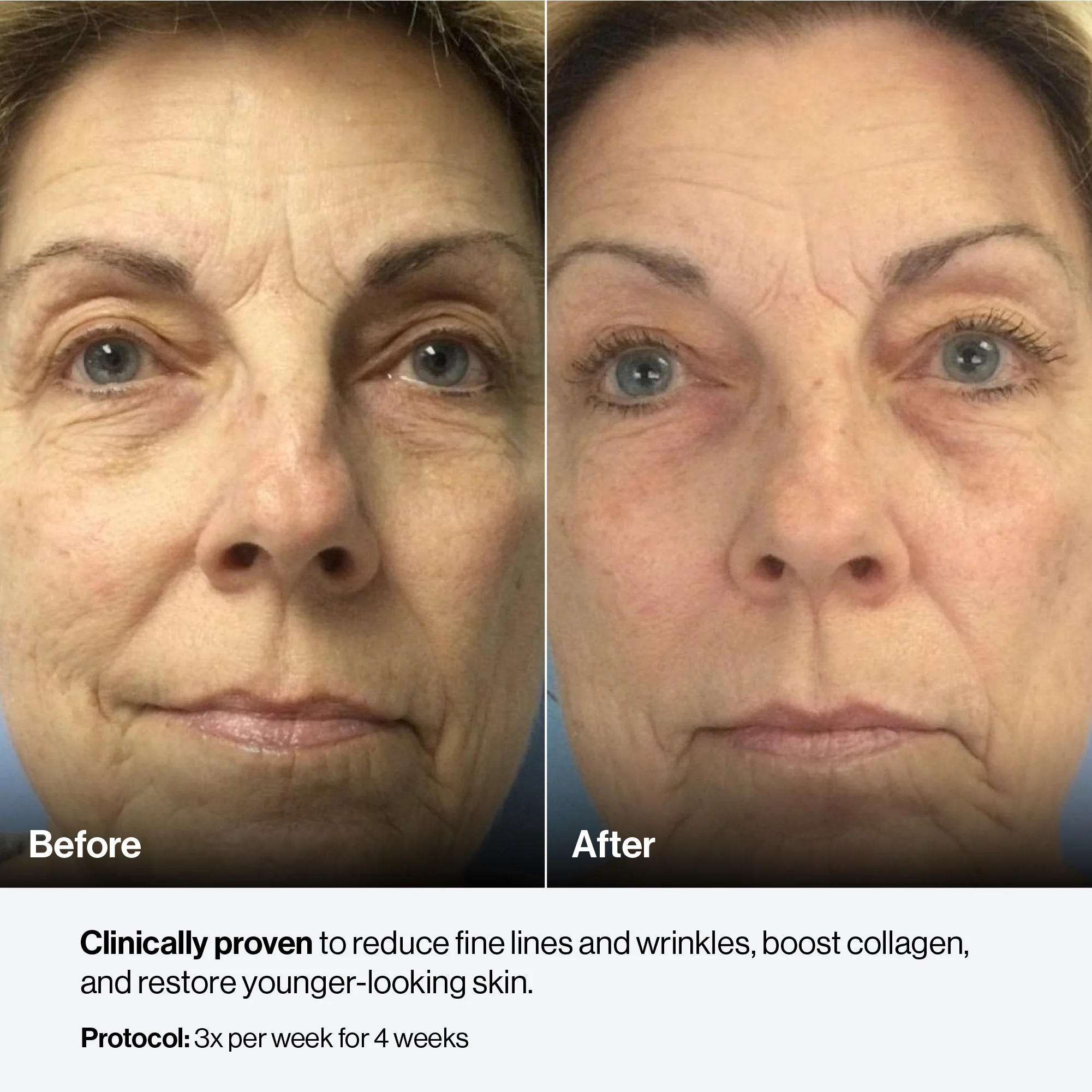 Celluma PRO - Image 5