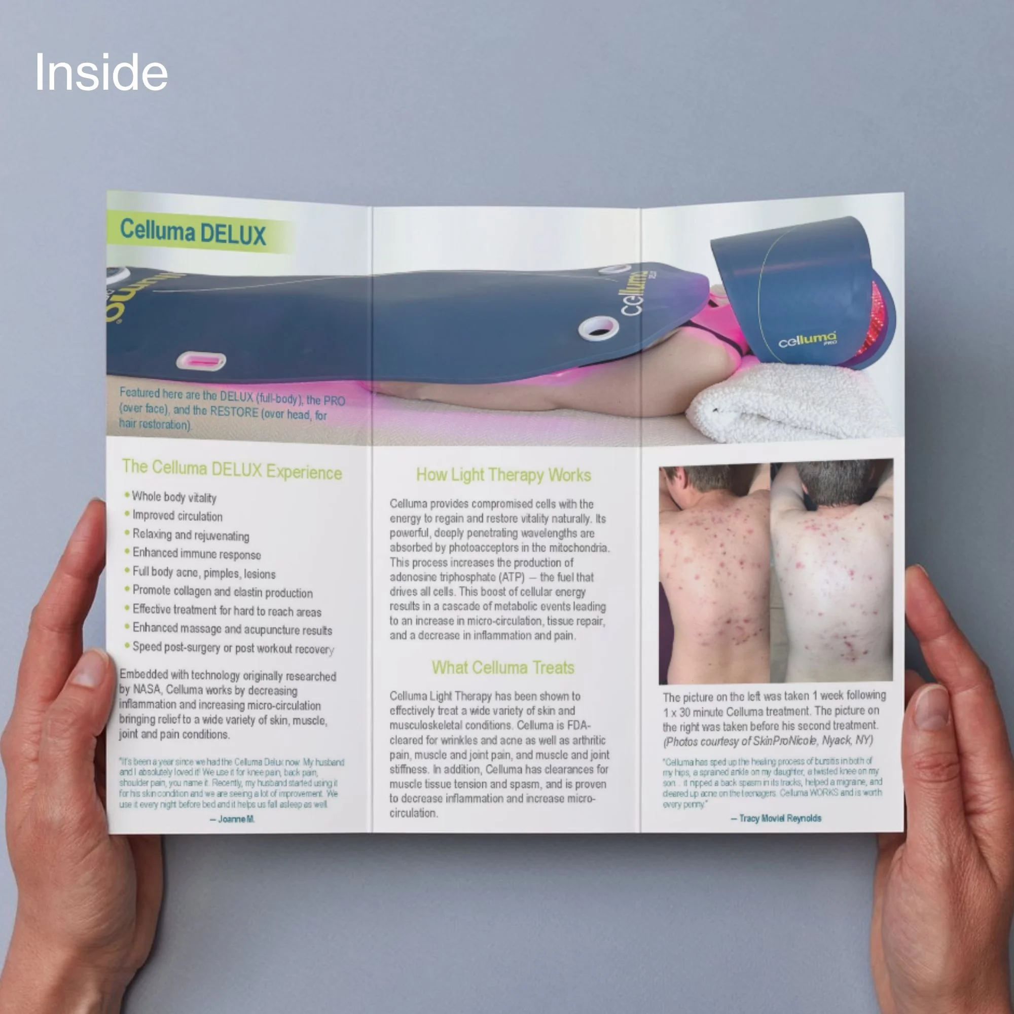 Celluma DELUX Patient Brochures – 50PK - Image 2