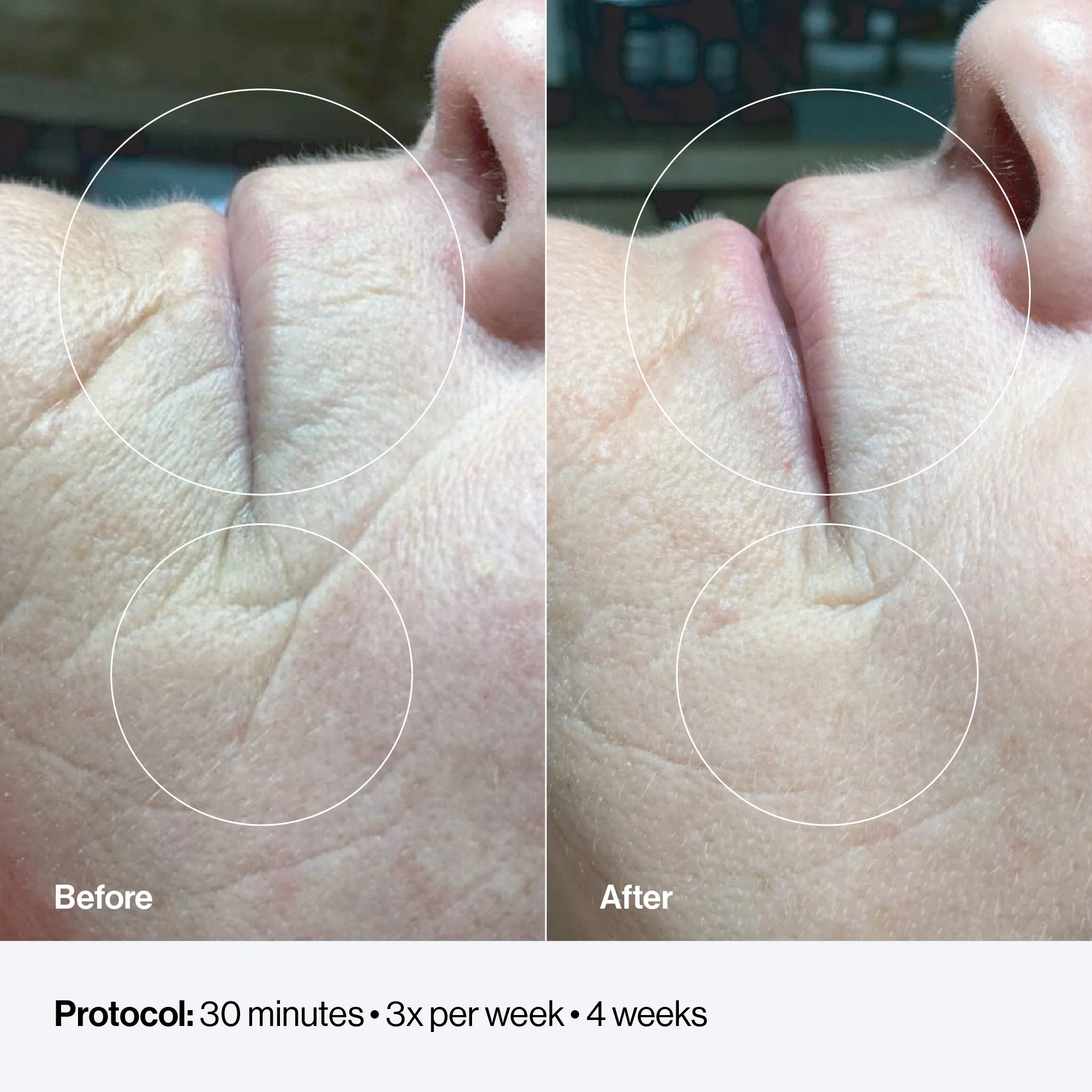 Celluma RESTORE - Image 6